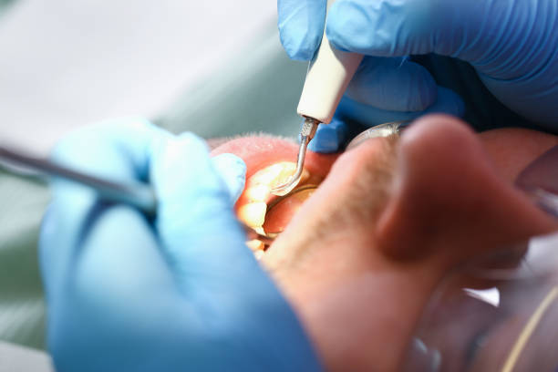 Best Broken Tooth Emergency  in Dale City, VA